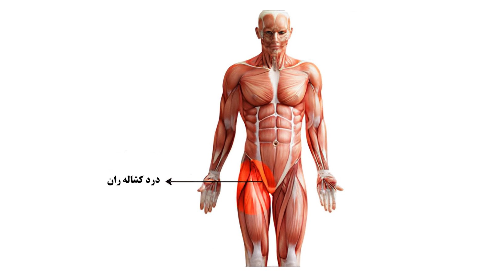 درد کشاله ران چقدر شایع است